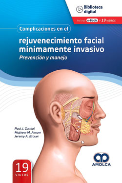 Complicaciones en el Rejuvenecimiento Facial Mínimamente Invasivo