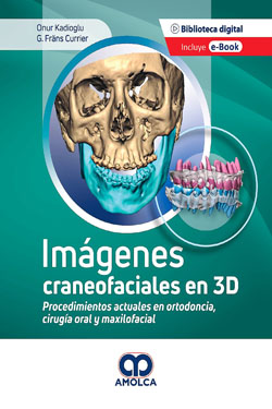 Imgenes Craneofaciales en 3D