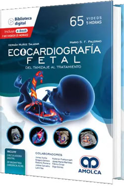 Ecocardiografía Fetal