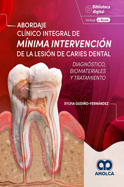 Abordaje Clínico Integral de Mínima Intervención de la Lesión de Caries Dental