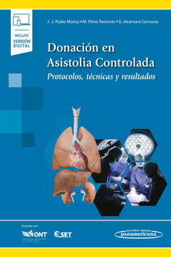 Donación en Asistolia Controlada