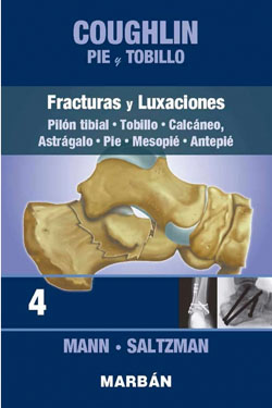 4 Coughlin Pie y Tobillo Fracturas y Luxaciones