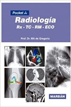 Pocket de Radiología Rx - TC - RM - ECO