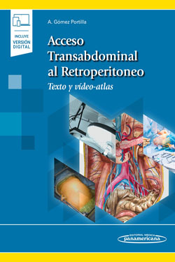 Acceso Transabdominal al Retroperitoneo + Ebook
