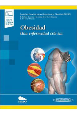 Obesidad