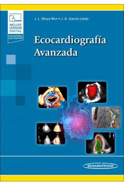 Ecocardiografía Avanzada