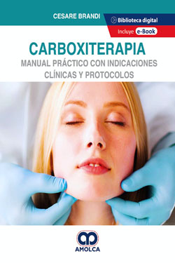 Carboxiterapia