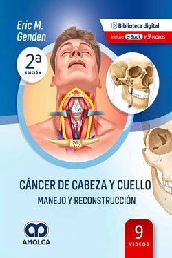 Cáncer de Cabeza y Cuello