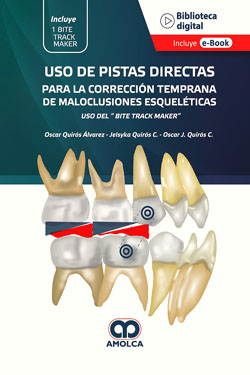 Uso de Pistas Directas para la Correccin Temprana de Maloclusiones Esquelticas.