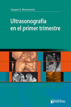 Ultrasonografía en el Primer Trimestre