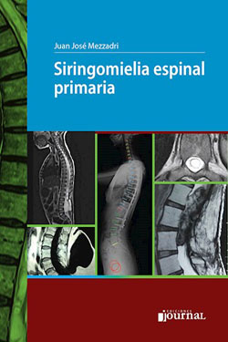 Siringomielia espinal primaria