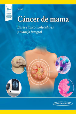 Cáncer de Mama