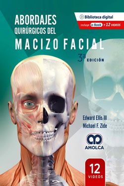 Abordajes Quirúrgicos del Macizo Facial