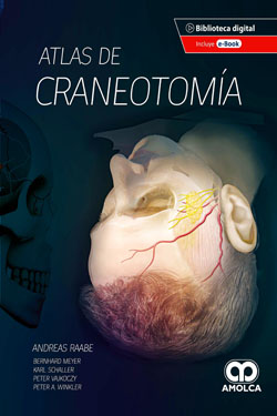 Atlas de Craneotomía