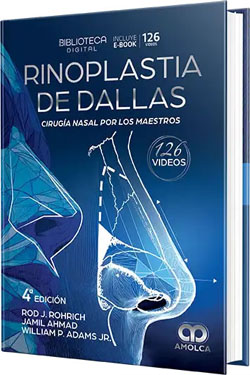 Rinoplastia de DALLAS