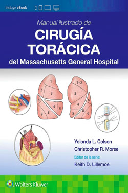 Manual Ilustrado de Cirug�a Tor�cica del