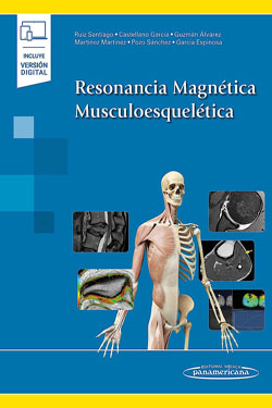 Resonancia Magnética Musculoesquelética