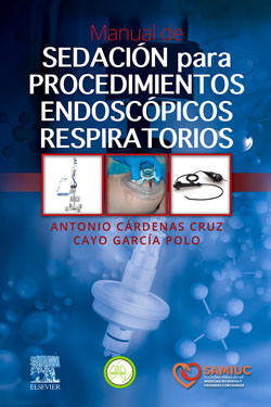 Manual de Sedación para Procedimientos Endoscópicos Respiratorios