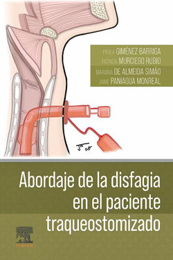 Abordaje de la Disfagia en el Paciente Traqueostomizado