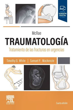 McRAE Traumatología