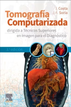 Tomografía Computarizada Dirigida a Técnicos Superiores en Imagen para el Diagnóstico