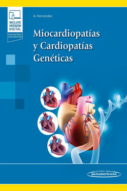 Miocardiopatas y Cardiopatas Genticas