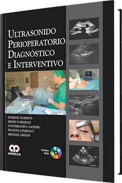 Ultrasonido Perioperatorio Diagnóstico e Interventivo